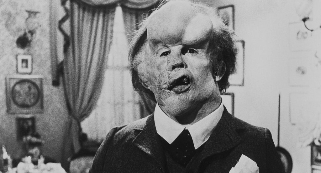 Elephant Man